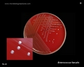 enterococcus faecalis